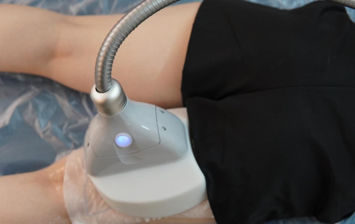 Which cryolipolysis applicator for which body area — Wing, Flat, Arct placement guide